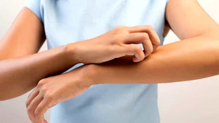 Perilla e Ribes Nigrum: piante sicure ed efficaci contro l’allergia